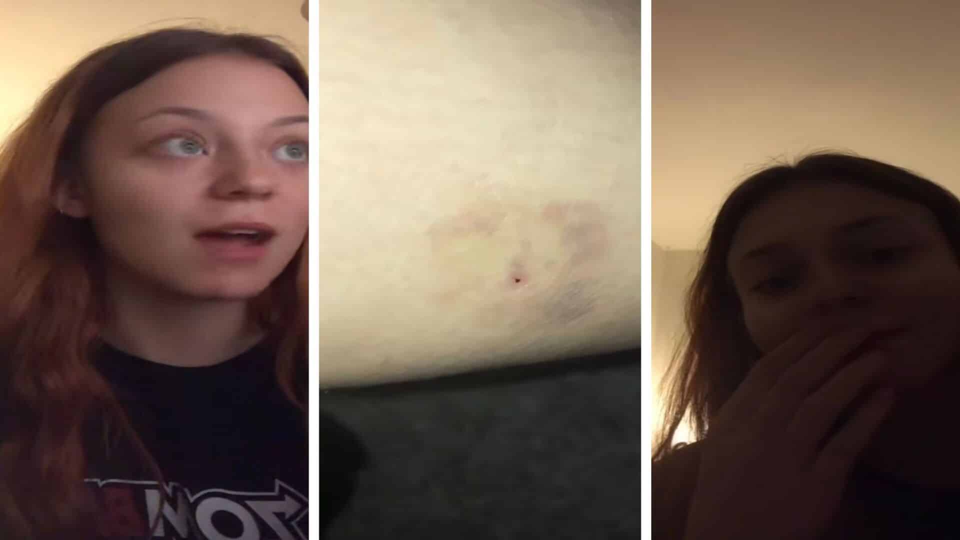 TikToker Believes She was Illegally Injected after watching a TikTok