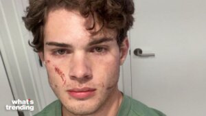 "Looksmaxxing" influencer Braden "Clavicular" Peters is facing intense scrutiny following a suspected overdose on livestream.