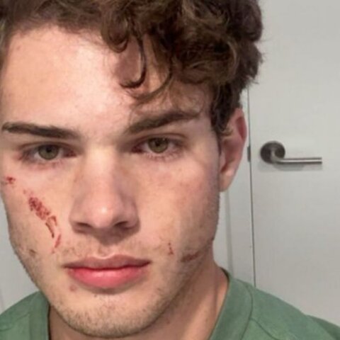 "Looksmaxxing" influencer Braden "Clavicular" Peters is facing intense scrutiny following a suspected overdose on livestream.